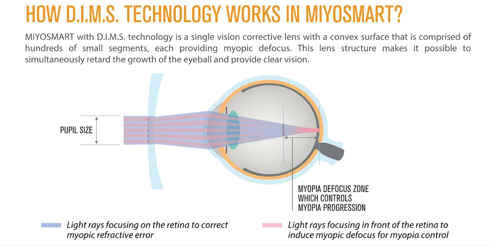 כיצד פועלת טכנולוגיית D.I.M.S. בעדשות MiYOSMART